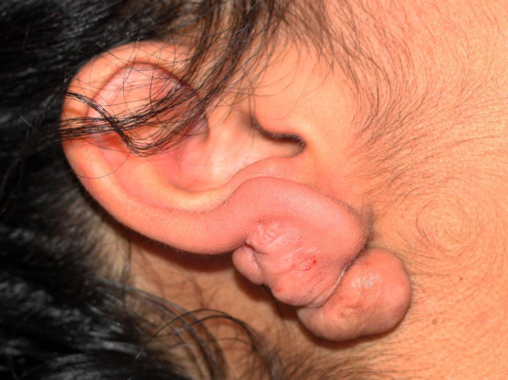 Patients were assessed