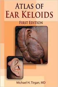 Atlas of Ear Keloids, 1st Edition