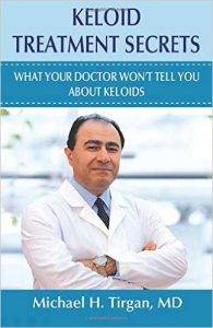 Keloid Treatment Secrets: What Your Doctor Wont Tell You.