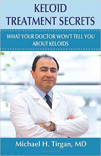 Keloid Treatment Secrets.