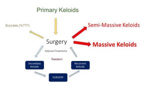 Why keloid surgery is bad?