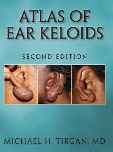 Atlas of Ear Keloids, 2nd Edition